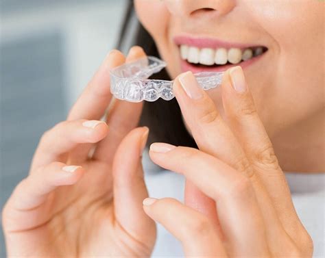 Aligners For Teeth