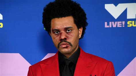 Mtv Vmas Heres Why The Weeknd Had A Bloody Face Glamour Free