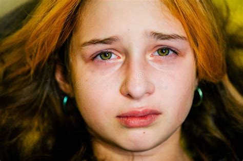 Little Sad Girl After Crying Crying Little Beautiful Girl With Sad Green Eyes And Frowning Face