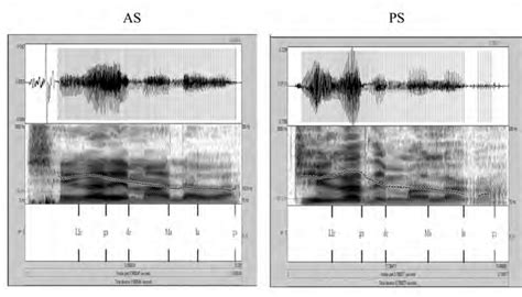 Speech Waveform And Spectrogram With An Overlapped F0 Trace For The