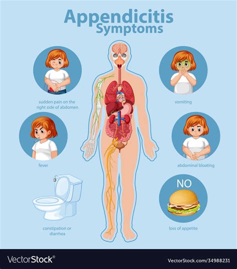 Appendicitis Symptoms Information Infographic Vector Image
