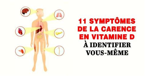 11 Symptômes De La Carence En Vitamine D à Identifier Vous Même