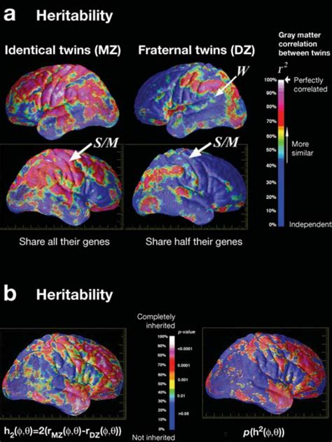 Is Iq Difference Detectable With Mri Or Eeg In Other Words Do High Iq