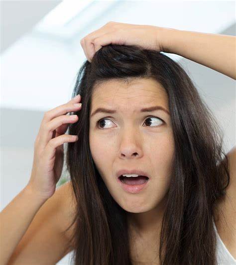 Step by step instructions to Use Apple Cider Vinegar To Cure Dandruff Benefits + Side Effects