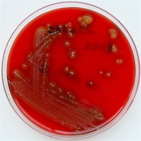 Streptococcus Pyogenes Quip Labs