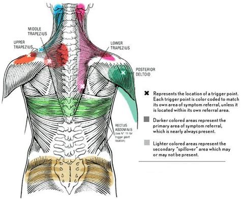 They are categorized by the muscles which they affect (primary and secondary), as well as the equipment required. Trigger points - a typical source for pain | David's GT Fitness Blog