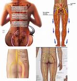 Images of Chiropractic Treatment For Sciatica