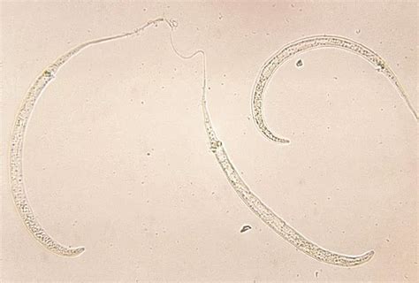 The Most Dangerous Human Parasites Ever Discovered