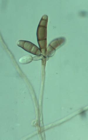 In general, conidia are dispersed passively, but in a few cases discharge is violent. Conidia