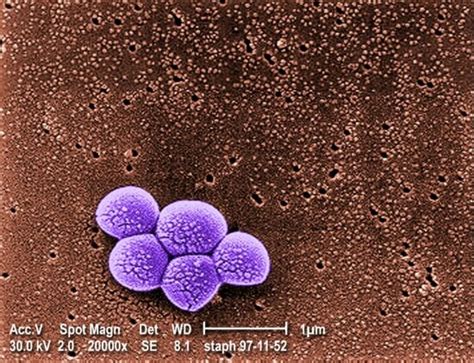 Free Picture Methicillin Resistant Staphylococcus Aureus Bacteria