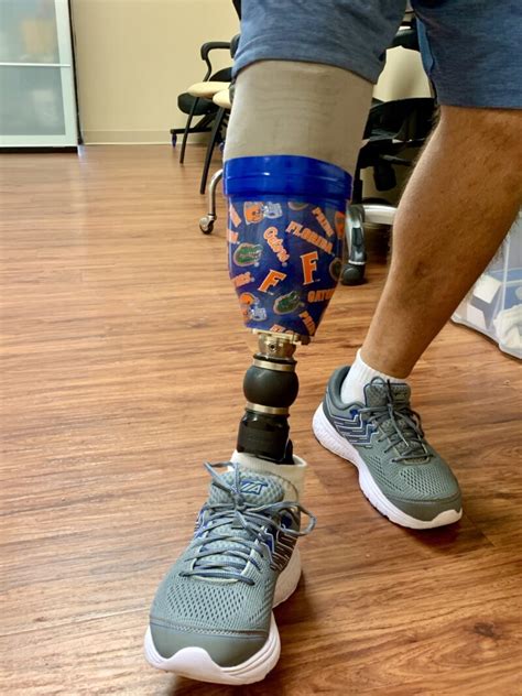 Below Knee Prosthesis Ronald Westcoast Brace And Limb Testimonial