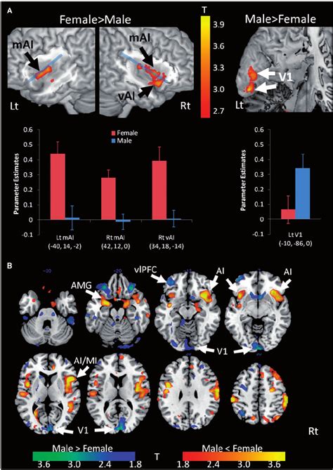 Sex Differences In The Association Between Neural Responses And