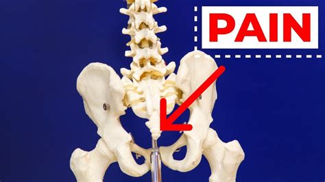 1 Treatment For Tail Bone Or Sits Bone Pain Giveaway Youtube