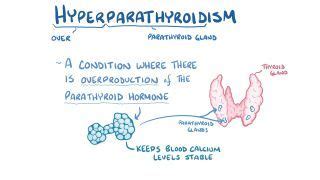 Hyperparathyroidism And Hypoparathyroidism Notes Diagrams