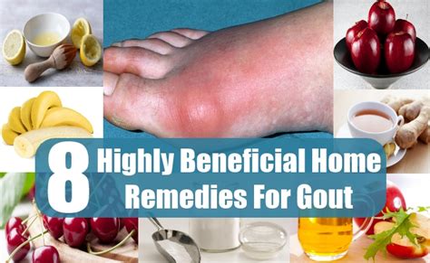 What Is Home Remedy For Gout