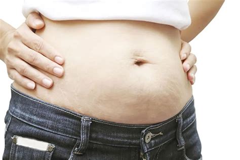 This Is One Reason Post Pregnancy Weight Gain Matters Healthywomen