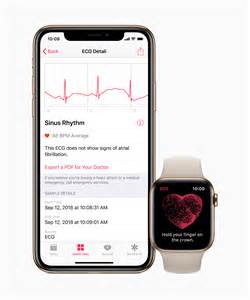 With a ton of features, easy setup, and centralized monitoring, it is easy to see why so many parents are mspy. Apple's highly anticipated heart monitoring feature is ...