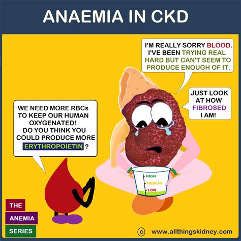 Anaemia In Ckd All That You Must Know All Things Kidney ~ Official