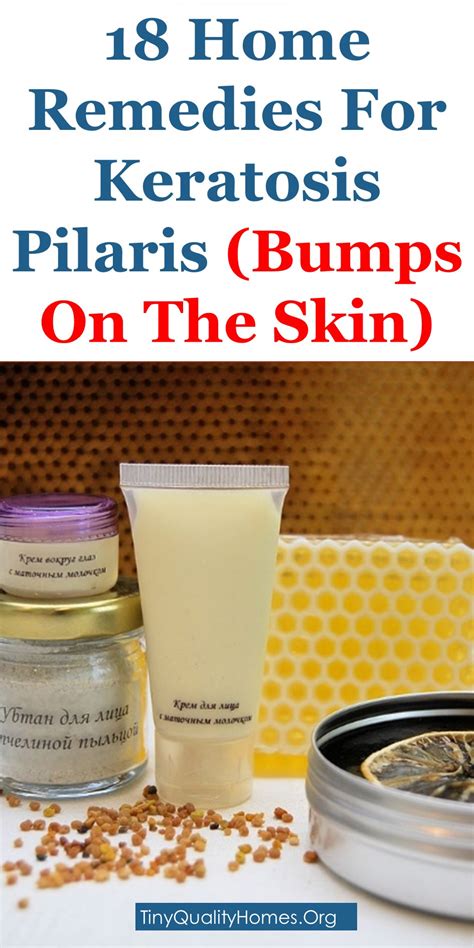 18 Home Remedies For Keratosis Pilaris Bumps On The Skin