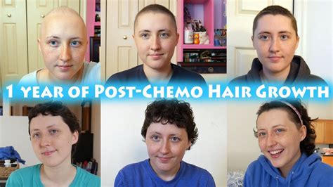 Hair Growth After Chemo One Year My Cancer Story Youtube