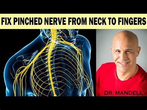 How To Fix A Pinched Nerve In The Neck Causes Symptom