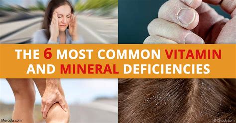 Symptoms Of Vitamin Deficiencies Chart