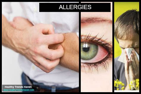 All You Need To Know About Allergies Causes Symptoms And Types