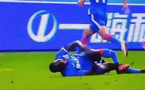 Injury history, suspensions and absences are based on a variety of media reports and are researched with the. (Video) Demba Ba leg break: Horrific footage
