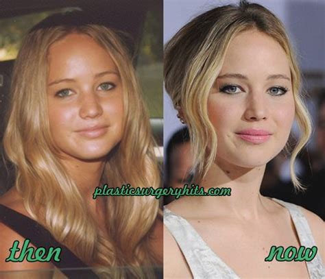 Jennifer Lawrence Plastic Surgery Before And After Jennifer Lawrence