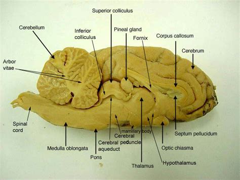 Anatomy Of Sheep Brain Scienceforyou