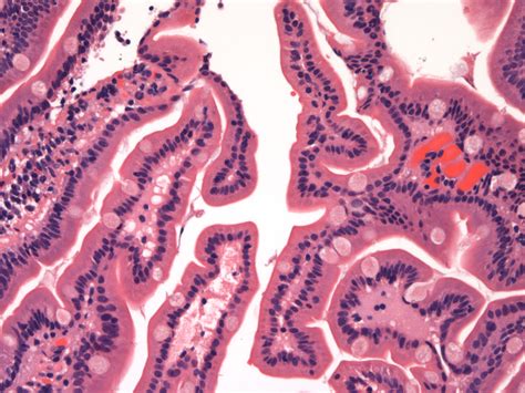 Small Intestine Histology Labeled Lab Practical Pics Anatomy My XXX