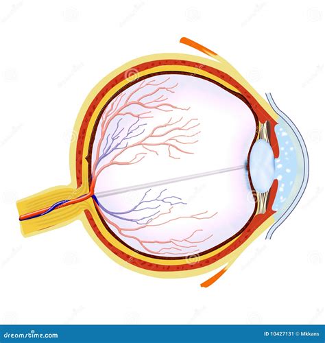 Retinal Detachment Vector Illustration Diagram Anatomical Scheme