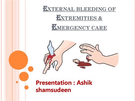 External Bleeding Of Extremities And Emergency Care презентация онлайн