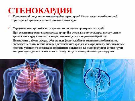 Ишемическая болезнь сердца какая диета Ишемическая болезнь сердца - презентация, доклад, проект скачать Ишемическая болезнь сердца - презентация, доклад, проект скачать Ишемическая болезнь сердца какая диета