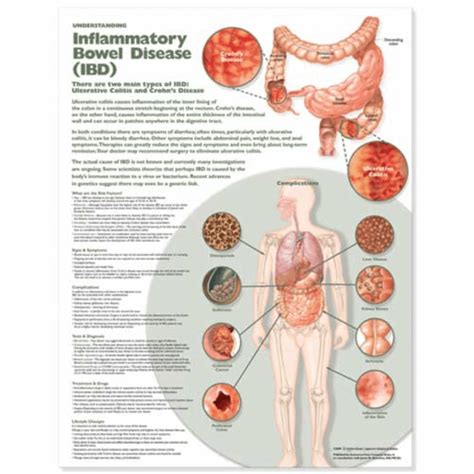 Symptoms may range from mild to severe. Understanding Inflammatory Bowel Disease (IBD) Anatomical ...