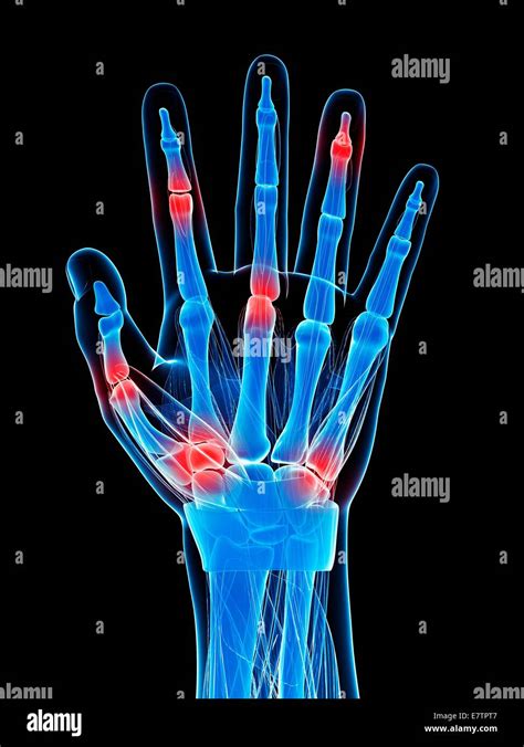 Human Finger Joints Computer Artwork Stock Photo Alamy