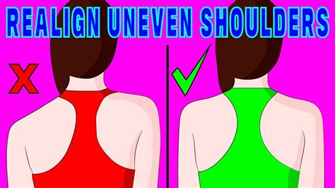 How To Fix Uneven Shoulders Naturally The Natural Method Youtube
