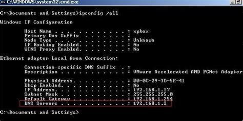 How To Find Dns Servers