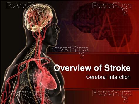 Ppt Overview Of Stroke Powerpoint Presentation Free Download Id