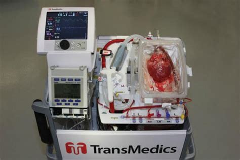 Ucla Teams Up With Transmedics To Revolutionize The Future Of Heart