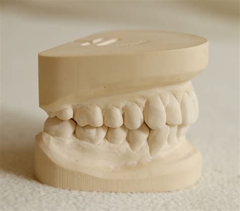 Digital Dental Models Compare Favourably With Plaster Models
