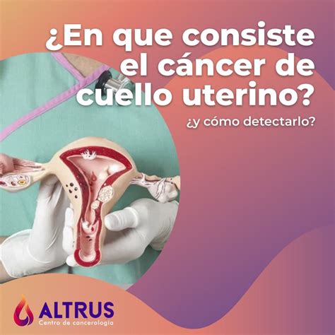 Cáncer de cuello uterino Altrus Cancerología