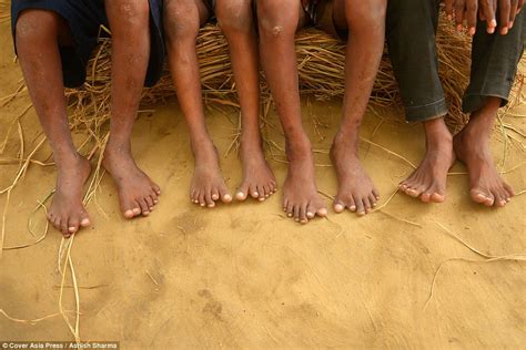 Experts Baffled By Group Of Relatives In India Who All Have Fingers And Toes Daily Mail