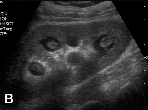 Figure 4 Ultrasound Sonography Ultrasound Radiology Imaging