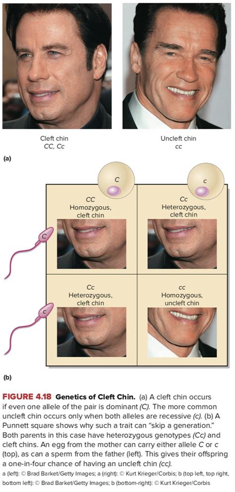 How Is A Cleft Chin Inherited Quora