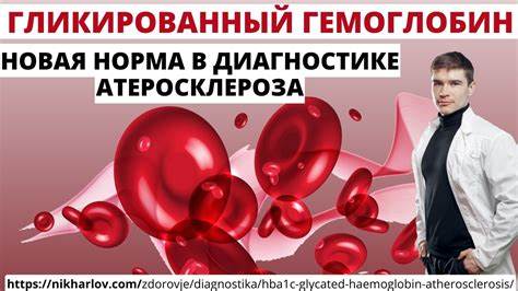 Гликированный диабет диета Гликированный гемоглобин НОРМА HbA1c. Атеросклероз Сахарный диабет 2 типа Гликированный гемоглобин НОРМА HbA1c. Атеросклероз Сахарный диабет 2 типа Гликированный диабет диета