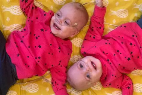 Worlds Most Premature Twins Now Happy Three Year Olds Guinness World Records