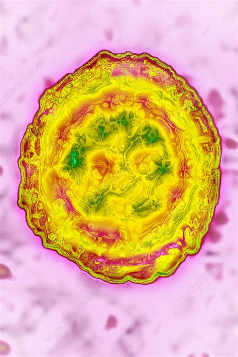 In rare cases, as when someone's immune system is severely compromised, this virus can cause infection of the brain (encephalitis). Herpes Simplex Virus 1, TEM - Stock Image - C036/2623 - Science Photo Library