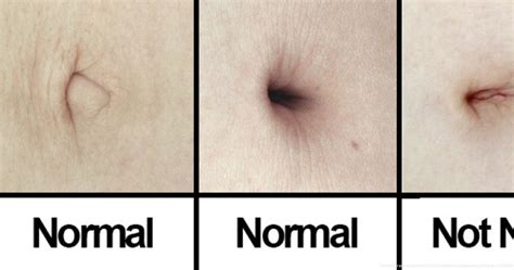 You Can Not Imagine These 10 Facts About Belly Button