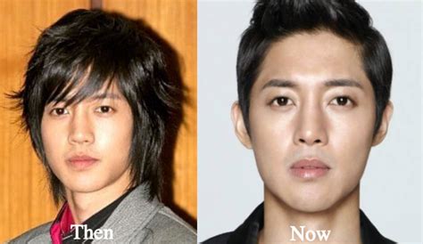 Kim Hyun Joong Plastic Surgery Before And After Photos Latest Plastic Surgery Gossip And News